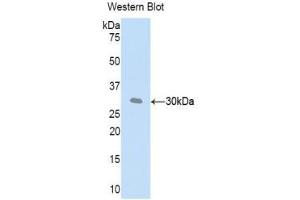 Western blot analysis of recombinant Mouse CFD. (Adipsin 抗体  (AA 1-259))