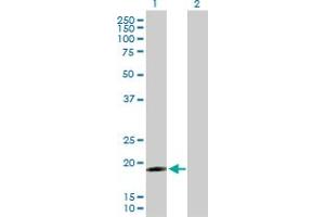 Western Blot analysis of IFNA17 expression in transfected 293T cell line by IFNA17 MaxPab polyclonal antibody. (IFNA17 抗体  (AA 1-189))