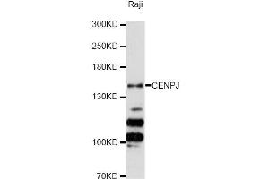 Western blot analysis of extracts of Raji cells, using CENPJ Antibody (ABIN5996394) at 1:3000 dilution. (CENPJ 抗体)