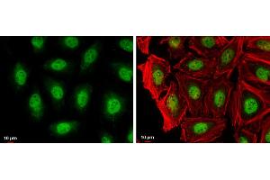 Immunofluorescence (IF) image for anti-Recombination Activating Gene 2 (RAG2) (Center) antibody (ABIN2856698)