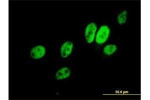 Immunofluorescence of purified MaxPab antibody to ERCC8 on HeLa cell. (ERCC8 抗体  (AA 1-396))