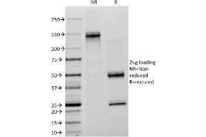 SDS-PAGE Analysis Purified Creatine Kinase-B (CKB) Mouse Monoclonal Antibody (CKB/1268). (CKB 抗体)
