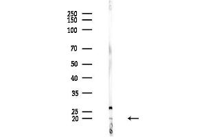 anti-Myosin Light Chain 4, Alkali, Atrial, Embryonic (MYL4) (N-Term) antibody
