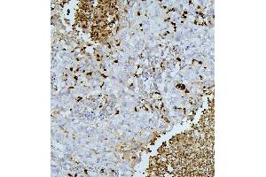 IHC analysis of PEF1 using anti-PEF1 antibody (ABIN6719632). (PEF1 抗体  (AA 170-284))
