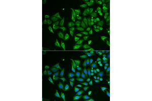 Immunofluorescence analysis of HeLa cells using CLEC3B antibody (ABIN5973819). (CLEC3B 抗体)