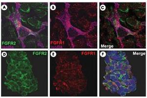 FGFR2/isolectinB4 (A) and FGFR1/isolectinB4 (B) staining of apparent mesenchymal cells and the subpopulation of endothelial cells. (FGFR2 抗体  (AA 22-51))