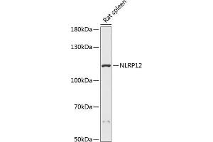 Western blot analysis of extracts of rat spleen, using NLRP12 antibody (ABIN7268937) at 1:3000 dilution. (NLRP12 抗体  (AA 862-1062))
