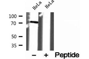 Western blot analysis of extracts of HeLa cells, using VPS33B antibody. (VPS33B 抗体)