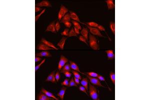 Immunofluorescence analysis of U2OS cells using TRIM4 Rabbit pAb (ABIN7270999) at dilution of 1:250 (40x lens). (TRIM4 抗体  (AA 1-280))
