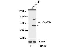 Western blot analysis of extracts from Mouse brain tissue using Phospho-Tau(S396) Polyclonal Antibody. (tau 抗体  (pSer396))