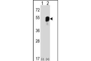 Western blot analysis of RS2 (arrow) using rabbit polyclonal RS2 Antibody (C-term) (ABIN6242575 and ABIN6577319). (PARS2 抗体  (C-Term))