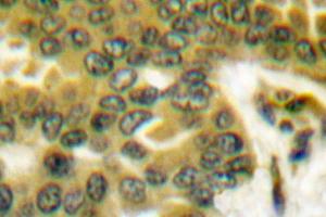 Image no. 1 for anti-Prostate Specific Antigen (PSA) antibody (ABIN271793) (Prostate Specific Antigen 抗体)