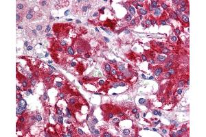 Immunohistochemistry (IHC) image for anti-Glutamate Decarboxylase 1 (Brain, 67kDa) (GAD1) (N-Term) antibody (ABIN785685) (GAD 抗体  (N-Term))