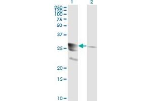 Western Blotting (WB) image for anti-GTP Cyclohydrolase 1 (GCH1) (AA 84-173) antibody (ABIN598708) (GCH1 抗体  (AA 84-173))