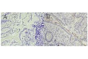 Immunohistochemistry (IHC) image for anti-Carcinoembryonic Antigen-Related Cell Adhesion Molecule 1 (CEACAM1) antibody (ABIN108725)