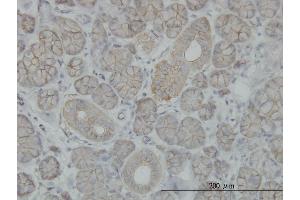 Immunostaining (ISt) image for anti-Solute Carrier Family 4, Sodium Bicarbonate Cotransporter, Member 8 (SLC4A8) (AA 187-286) antibody (ABIN564099)