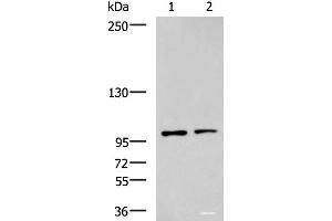Western blot analysis of Raji and HepG2 cell lysates using GLI1 Polyclonal Antibody at dilution of 1:900 (GLI1 抗体)