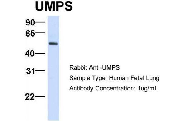 UMPS 抗体  (C-Term)