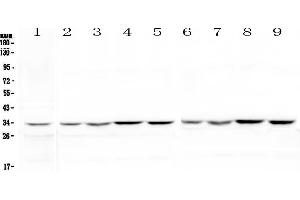 Western blot analysis of HLF using anti-HLF antibody . (HLF 抗体)