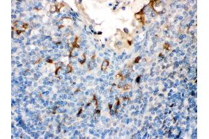 Filaggrin was detected in paraffin-embedded sections of human Tonsil tissues using rabbit anti- Filaggrin Antigen Affinity purified polyclonal antibody at 1 μg/mL. (Filaggrin 抗体  (AA 1-261))