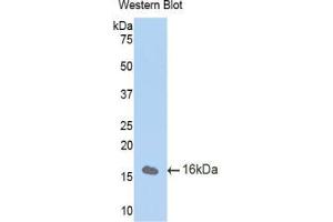 Western blot analysis of the recombinant protein. (CUBN 抗体  (AA 3157-3274))