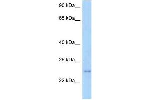 WB Suggested Anti-Tm2d3 Antibody Titration: 1. (TM2D3 抗体  (C-Term))