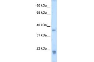 Western Blotting (WB) image for anti-Growth Hormone 2 (GH2) antibody (ABIN2462514)