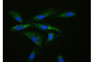 IF analysis of MPS1 using anti-MPS1 antibody (ABIN4886714).