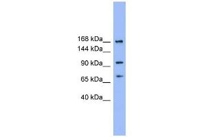 WB Suggested Anti-ADAMTS19 Antibody Titration:  0. (ADAMTS19 抗体  (N-Term))