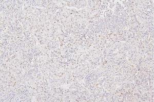 IHC analysis of H1F0 using anti-H1F0 antibody (ABIN7600521).