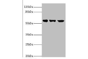 Western blot All lanes: Bardet-Biedl syndrome 4 protein antibody at 4 μg/mL Lane 1: Hela whole cell lysate Lane 2: U251 whole cell lysate Lane 2: Mouse heart tissue Secondary Goat polyclonal to rabbit IgG at 1/10000 dilution Predicted band size: 59, 60, 39 kDa Observed band size: 59 kDa (BBS4 抗体  (AA 350-519))
