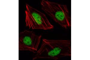 Fluorescent image of HUVEC cell stained with TBX15 Antibody (N-term) (ABIN1539402 and ABIN2849989). (T-Box 15 抗体  (N-Term))