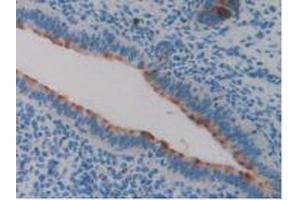 IHC-P analysis of Mouse Uterus Tissue, with DAB staining. (Clusterin 抗体  (AA 227-447))