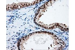 Immunohistochemical staining of paraffin-embedded Kidney tissue using anti-PTPRE mouse monoclonal antibody. (PTPRE 抗体)