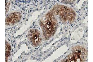 Immunohistochemical staining of paraffin-embedded Human Kidney tissue using anti-ALDOB mouse monoclonal antibody. (ALDOB 抗体)
