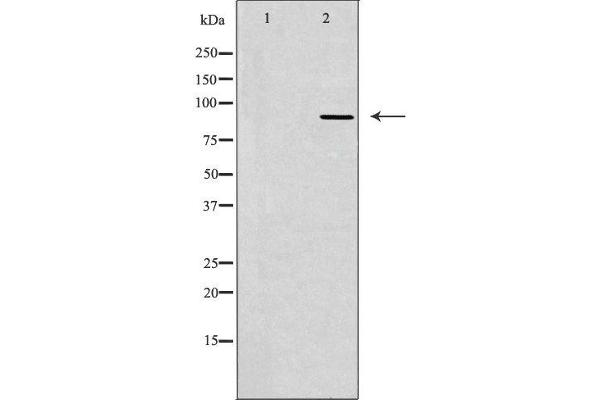TLK2 抗体  (Internal Region)