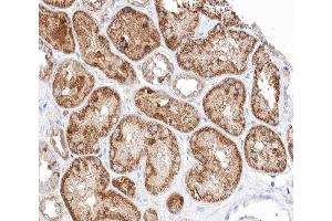 ABIN6266616 at 1/100 staining human kidney tissue sections by IHC-P. (Patched 1 抗体  (N-Term))
