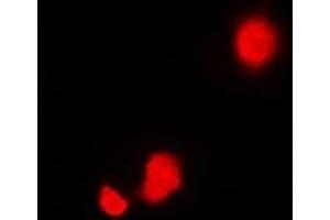 Immunofluorescent analysis of STIP1 staining in Hela cells. (STIP1 抗体)