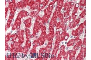 IHC-P analysis of Human Liver Tissue, with HE staining. (GBA 抗体  (AA 117-214))