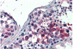 Human Testis (formalin-fixed, paraffin-embedded) stained with FHL1 antibody ABIN337221 at 2. (FHL1 抗体  (AA 261-272))