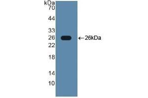 Detection of Recombinant TLR2, Human using Polyclonal Antibody to Toll Like Receptor 2 (TLR2) (TLR2 抗体  (AA 644-784))