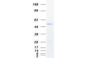 Western Blotting (WB) image for Tripartite Motif Containing 6 (TRIM6) (Transcript Variant 2) protein (Myc-DYKDDDDK Tag) (ABIN2734290)