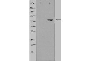 Western blot analysis of extracts from HuvEc cells, using ALS2CR8 antibody. (CDKN2AIP 抗体  (Internal Region))