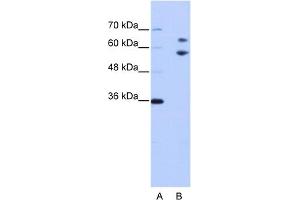 WB Suggested Anti-TROVE2 Antibody Titration:  0. (TROVE2 抗体  (N-Term))