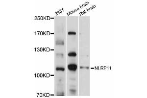 Western blot analysis of extracts of various cell lines, using NLRP11 antibody (ABIN6292815) at 1:1000 dilution.