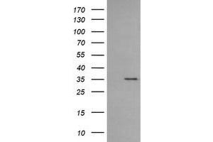 Western Blotting (WB) image for anti-T-cell surface glycoprotein CD1c (CD1C) antibody (ABIN1497190) (CD1c 抗体)