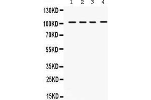 Western Blotting (WB) image for anti-Histone Deacetylase 7 (HDAC7) (AA 68-103), (N-Term) antibody (ABIN3042441) (HDAC7 抗体  (N-Term))