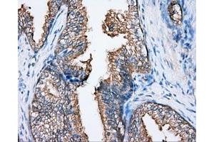 Immunohistochemical staining of paraffin-embedded Kidney tissue using anti-BTK mouse monoclonal antibody. (BTK 抗体)