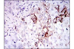 Immunohistochemistry (IHC) image for anti-Somatostatin (SST) (AA 1-116) antibody (ABIN1845358) (Somatostatin 抗体  (AA 1-116))