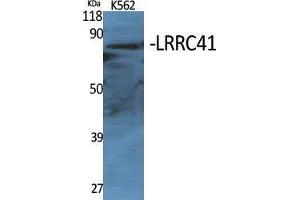 Western Blot (WB) analysis of specific cells using LRRC41 Polyclonal Antibody. (LRRC41 抗体  (Internal Region))